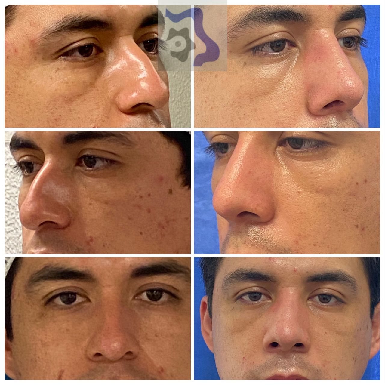Cesar Alfonso Gutierrez Espinosa-2