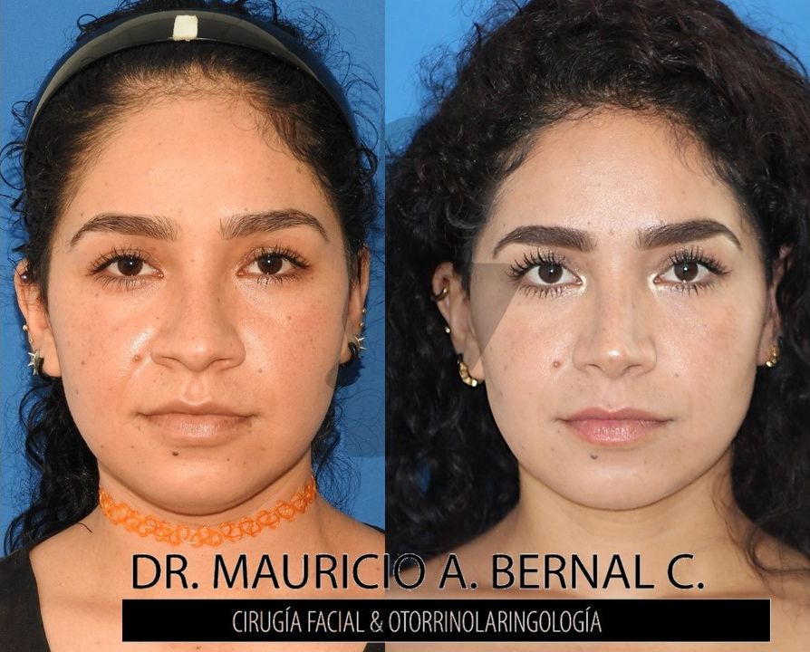 Mauricio Alejandro Bernal Carreon-0
