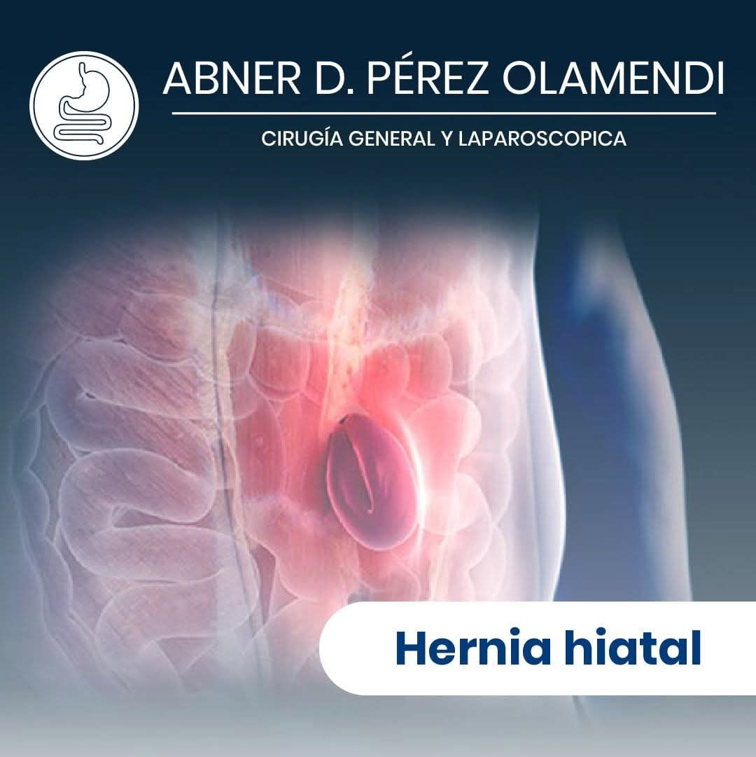 Abner Daniel Pérez Olamendi-1