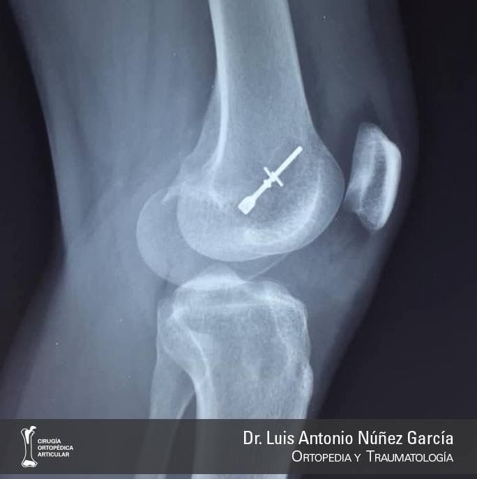 Luis Antonio Núñez García-0