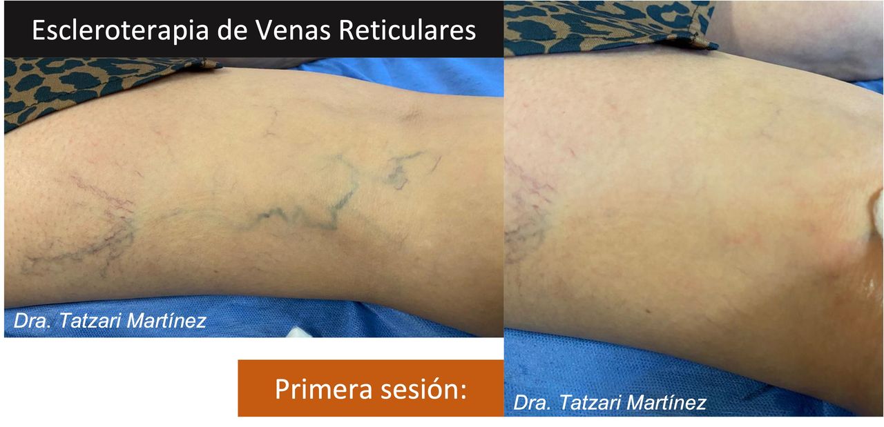 Tatzari Martinez Coria-0