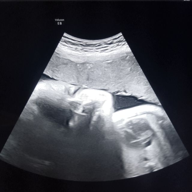 Rocio Myris Alemán Ramos, Radiólogo Coyoacán