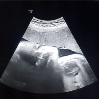 Ampliar imagen: Rocio Myris Alemán Ramos, Radiólogo Coyoacán