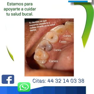 Anja Arroyo Campos, Endodoncia Morelia