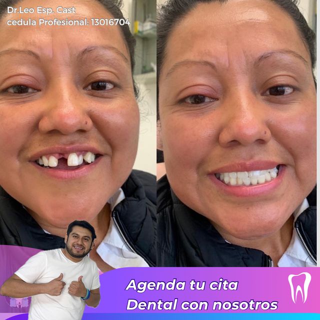 Leonel Espinoza Castillo, Dentista - Odontólogo Tehuacan