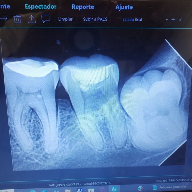 Ernesto Gómez, Dentista - Odontólogo Bahia de Banderas