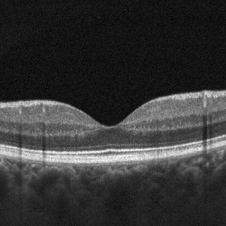 Ampliar imagen: Leonardo Méndez Suárez, Oftalmólogo Pachuca de Soto