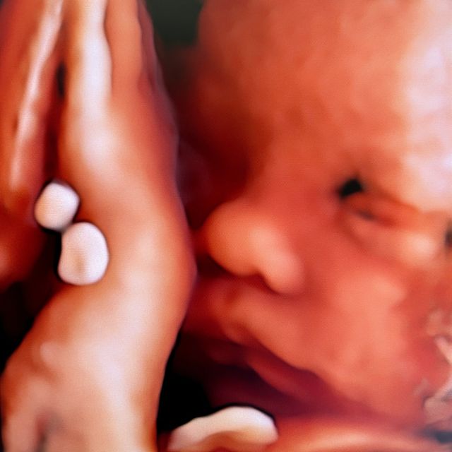 Daniel Horacio Alcaraz Martínez, Ginecólogo Ciudad Juarez