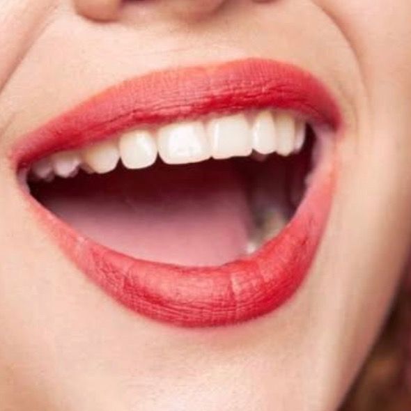 Sandra Moreno, Dentista - Odontólogo Santiago Tianguistengo-Gualupita Yancuitlalpan