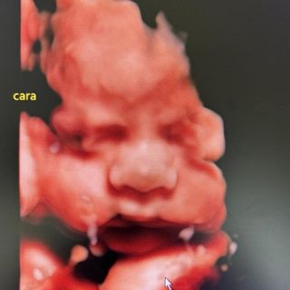 Ampliar imagen: Alejandro Bailón Calderón, Ginecólogo Tijuana