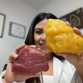 Estefania Mora, Nutricionista Puebla