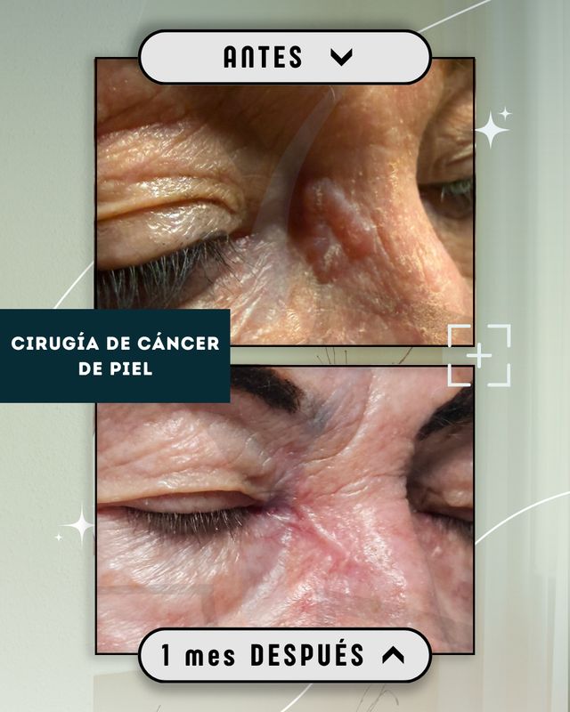 Ampliar imagen: Dermymed - Centro Dermatológico