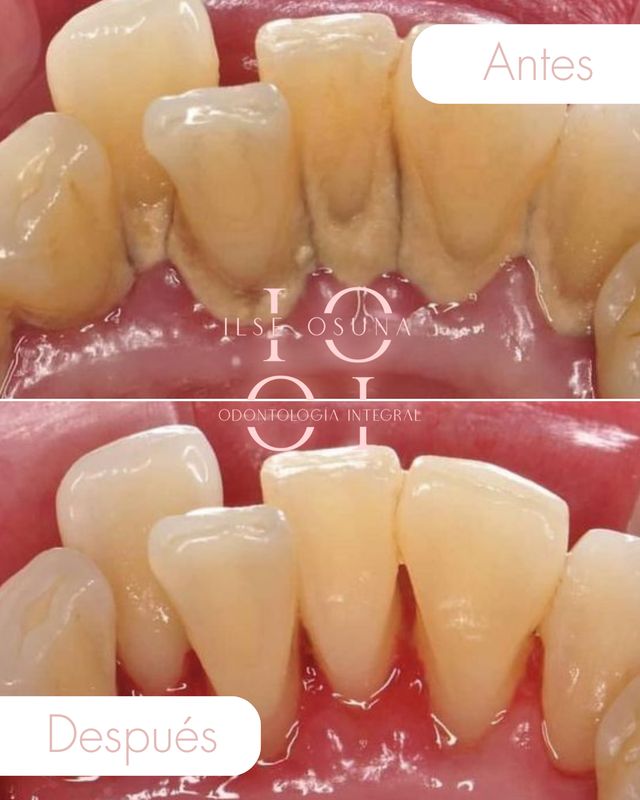 Ampliar imagen: Nogal 94