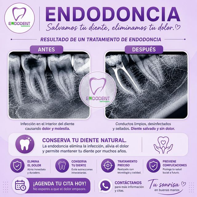 Ampliar imagen: ENDODENT Odontología Especializada