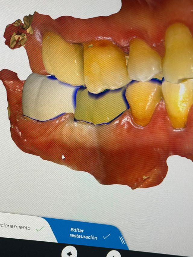 Ampliar imagen: Denticelis