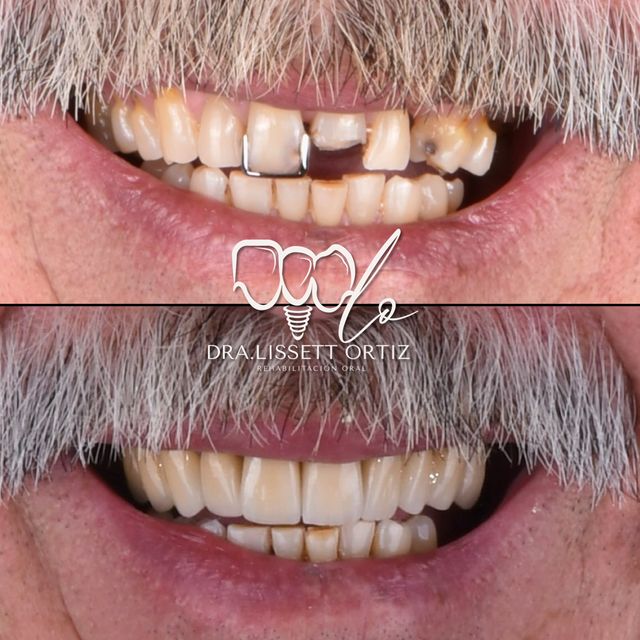 Ampliar imagen: Especialista en Rehabilitacion Oral e Implantologia