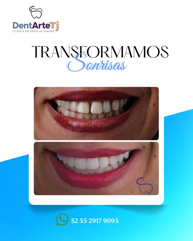 Ampliar imagen: DentArte