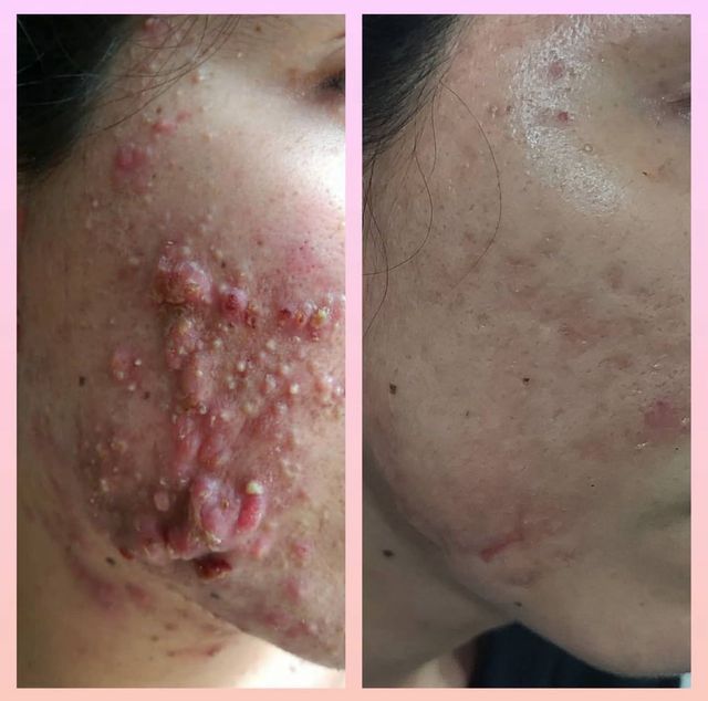 Ampliar imagen: Dérmica Klinik