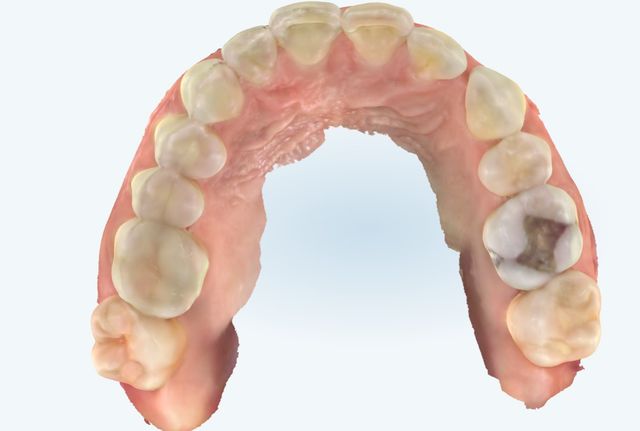 Ampliar imagen: Vivesonrisa Clínica Dental