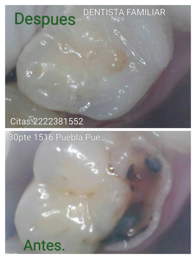 Ampliar imagen: DENTISTA FAMILIAR ORTODONCIA.