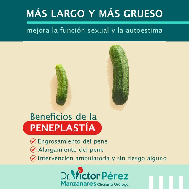 Ampliar imagen: DR. VICTOR PEREZ PROCEDIMIENTOS