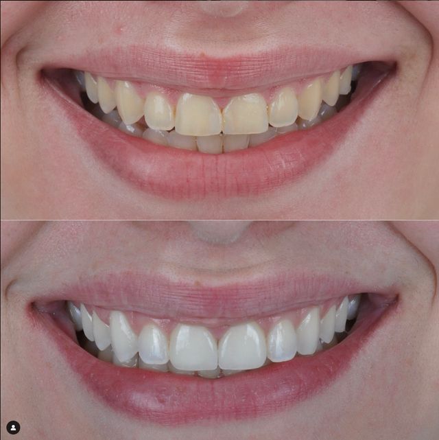 Ampliar imagen: Dentagrama