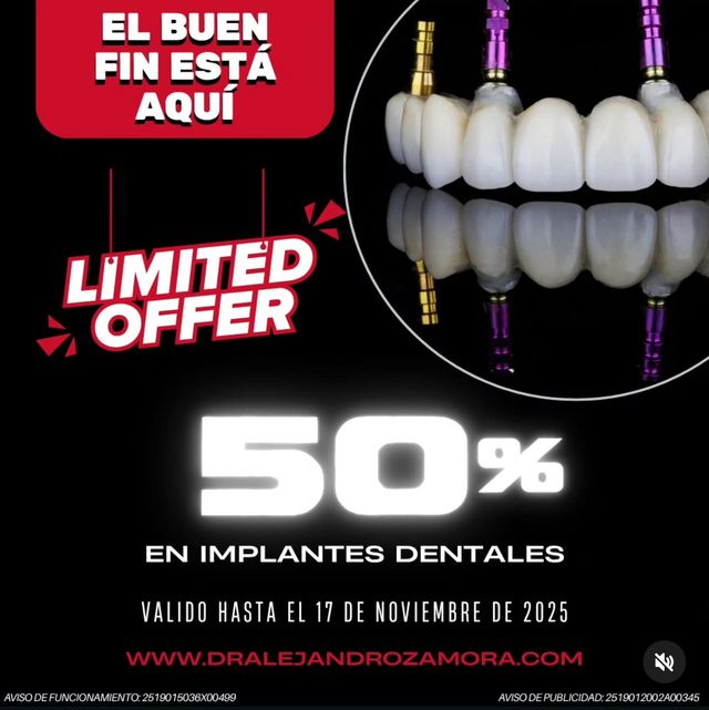 Ampliar imagen: implantologia-consulta en línea