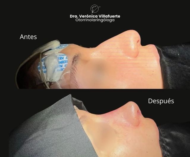 Ampliar imagen: San Angel Inn Universidad