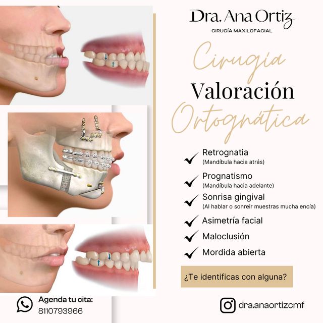 Ampliar imagen: Dra.Ana Ortiz- Cirugía Maxilofacial