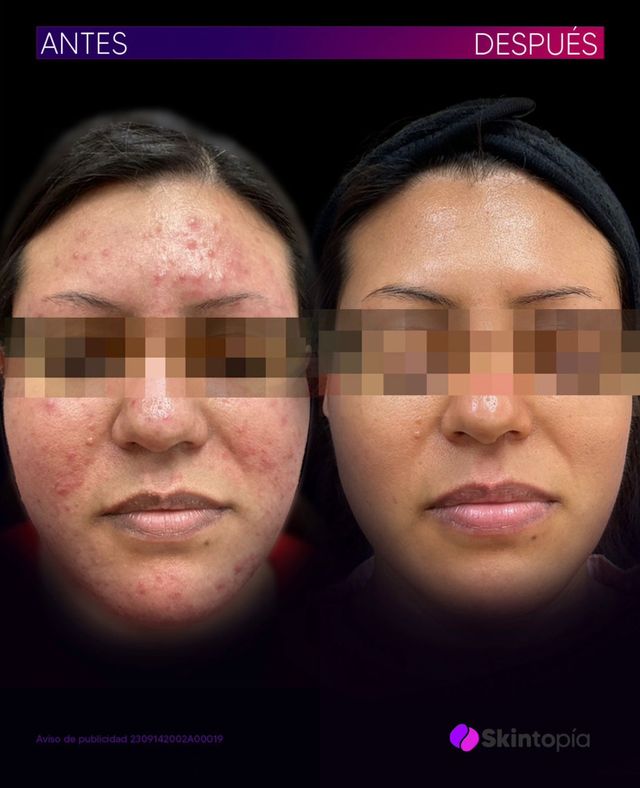 Ampliar imagen: SKINTOPIA