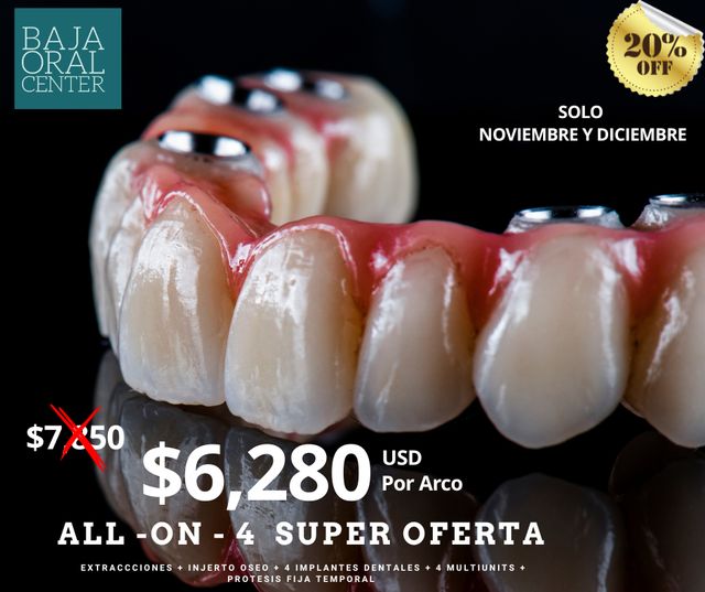 Ampliar imagen: BAJA ORAL CENTER