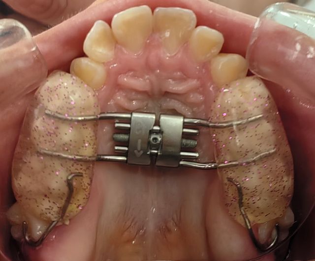 Ampliar imagen: ortho.odonto kids