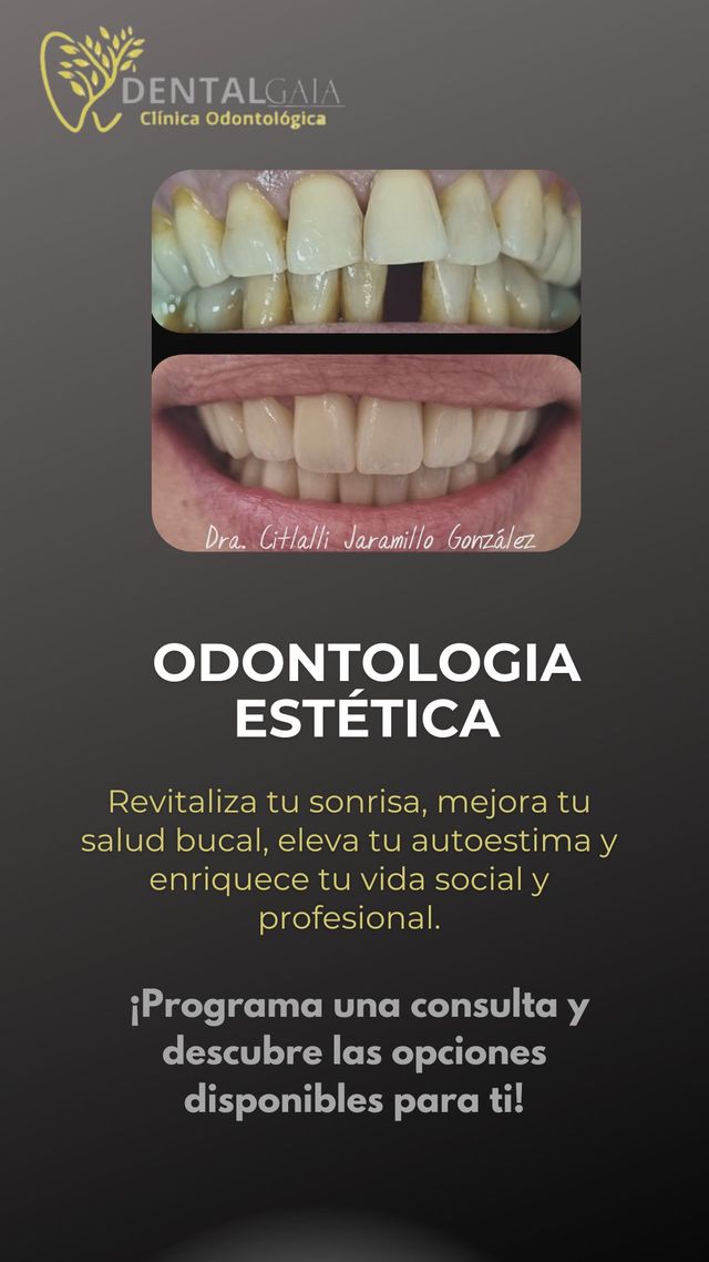 Ampliar imagen: Dental Gaia