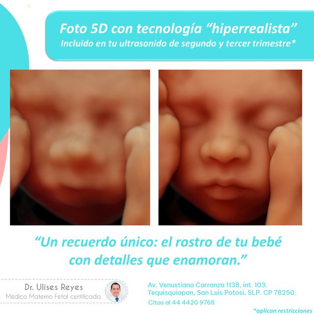 Ampliar imagen: MEDFETAL- San Luis Potosí