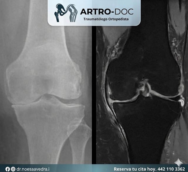 Ampliar imagen: Hospital Star Médica Querétaro, Piso 11, Consultorio 1105.