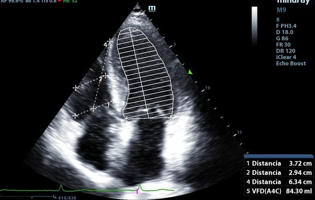 Ampliar imagen: Hospital Angeles Torreon