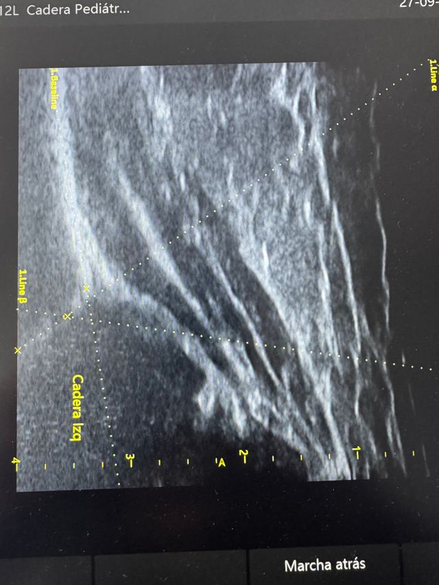 Ampliar imagen: Unitrauma