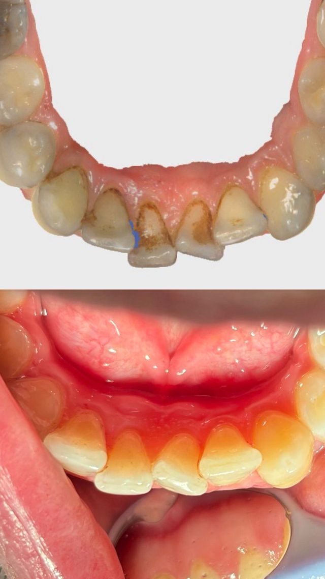 Ampliar imagen: KOBE