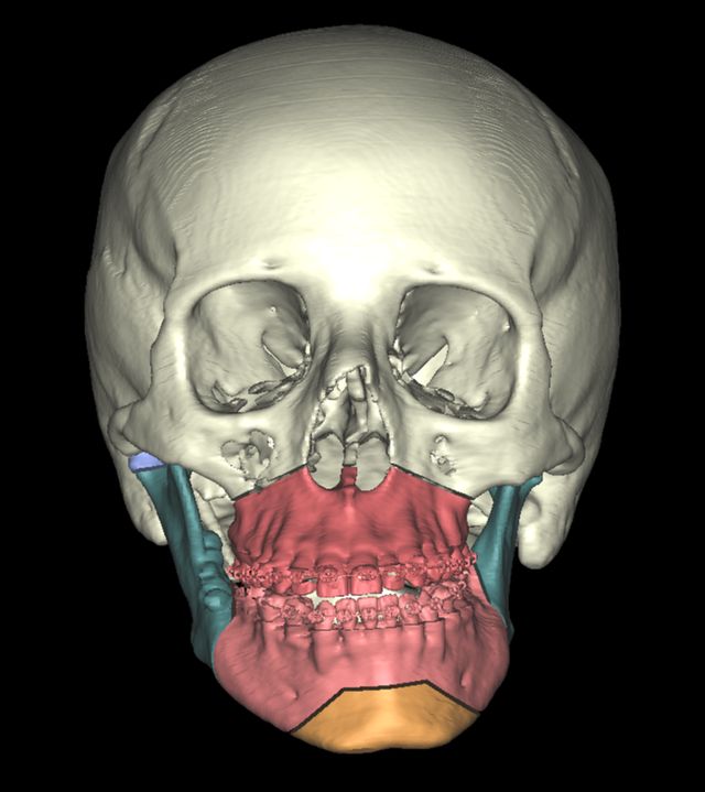 Ampliar imagen: Cirugía Maxilofacial ¨Dr Enrique Muñoz¨¨   STARMEDICA TLALNEPANTLA