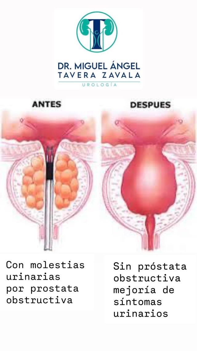 Ampliar imagen: URO HEALTH