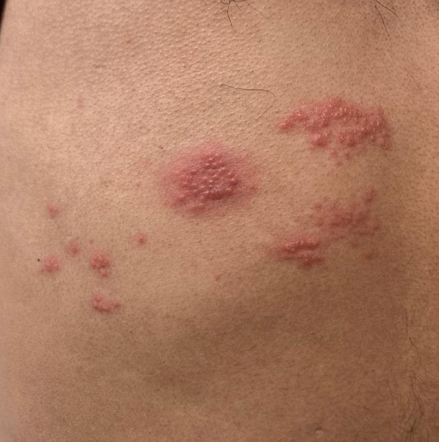 Ampliar imagen: Consultorio de Infectología y Medicina Interna