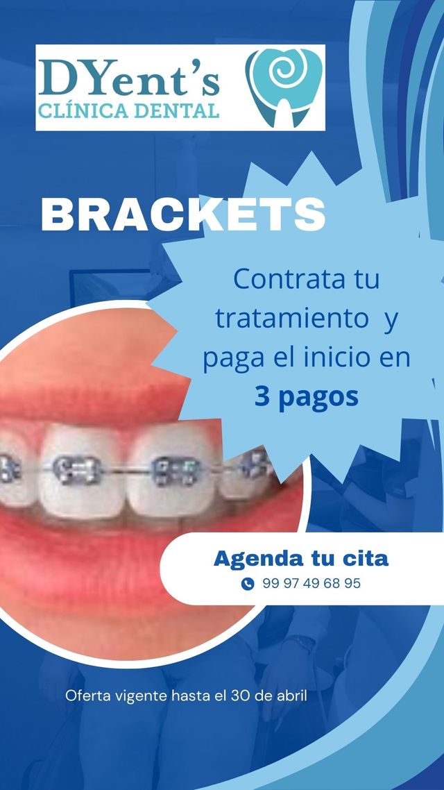 Ampliar imagen: DYent's Clínica Dental
