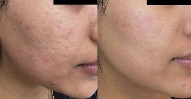 Ampliar imagen: DermaWise Clínica Dermatológica Especializada