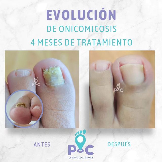 Ampliar imagen: Podologos Cerca (Podóloga Raquel Vera)