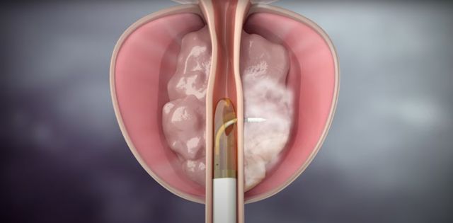 Ampliar imagen: Consulta en línea