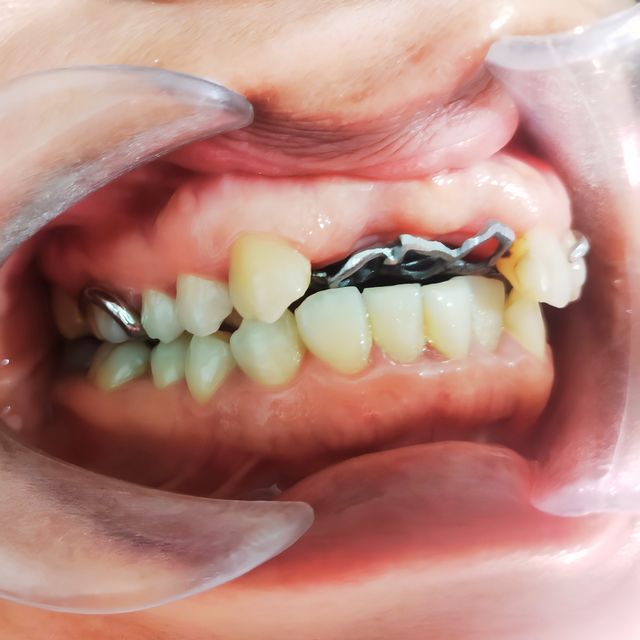 Ampliar imagen: DENTAL ELOHIM