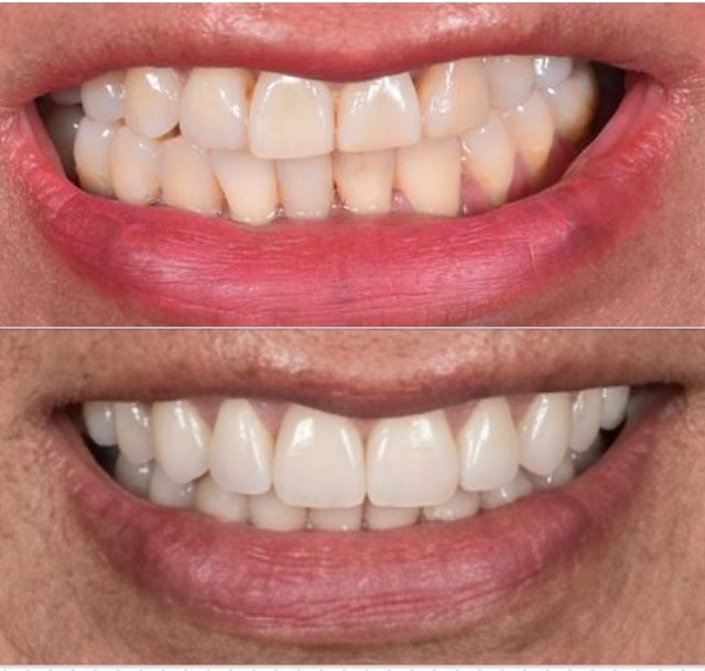Ampliar imagen: Consultorio Dental Mexicaltzingo