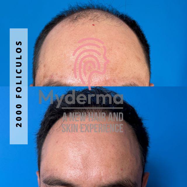 Ampliar imagen: Myderma Hair&Skin