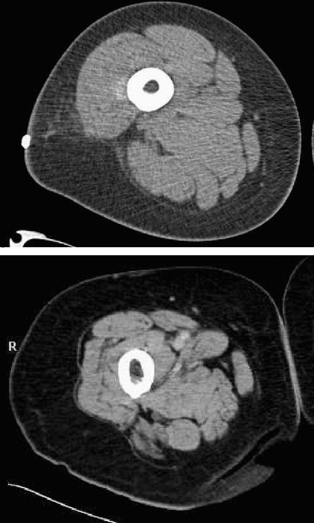 Ampliar imagen: Fisioterapia virtual (en línea)