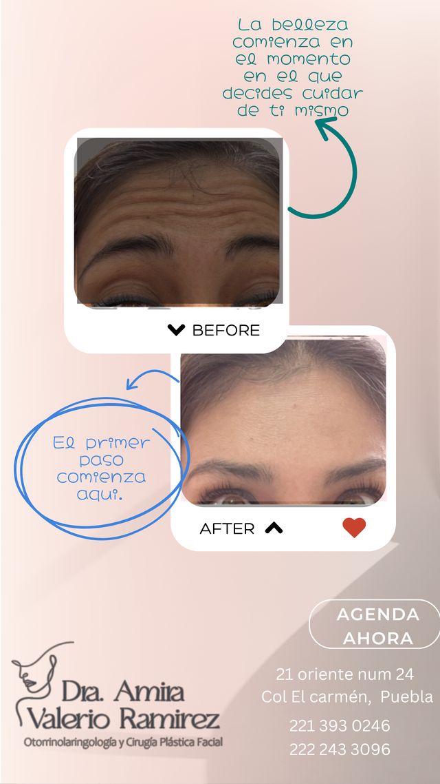 Ampliar imagen: Puebla